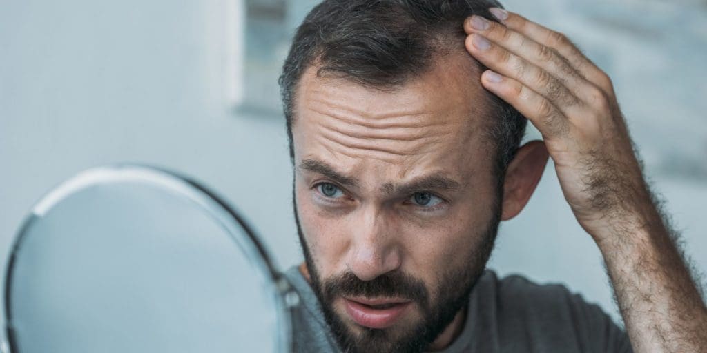A Man’s Guide to Hair Loss