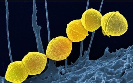 Public Health Wales issues statement on Strep A following recent cases