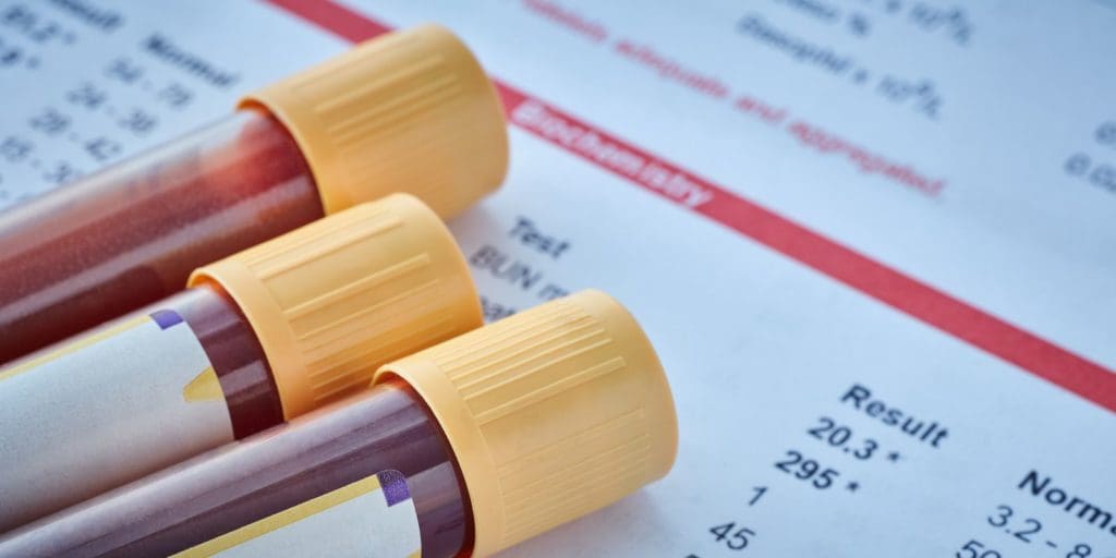 What Your Blood Can Reveal About Your Health