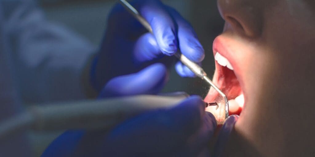 Wales is facing a dental emergency